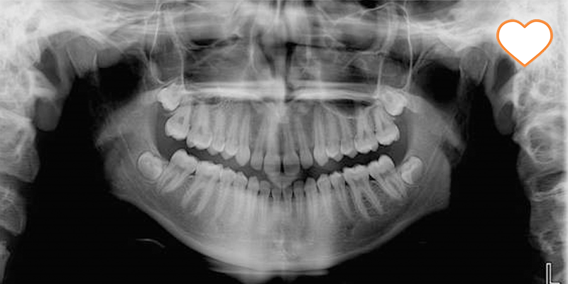Диагностика и планирование ортодонтического лечения